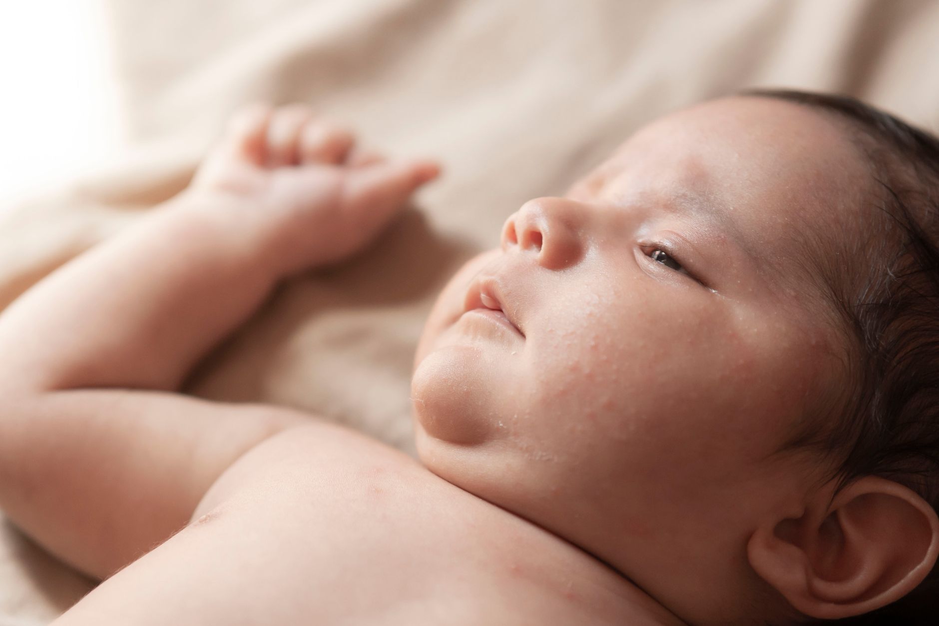 Bebê com dermatite atópica no rosto, pele ressecada e coçando